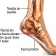 fascitis-plantar-podologia-galapagar